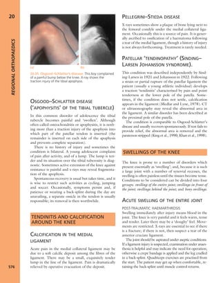 Apley's shoulderjt examination