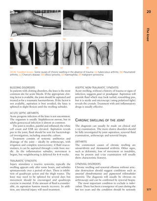 Apley's shoulderjt examination