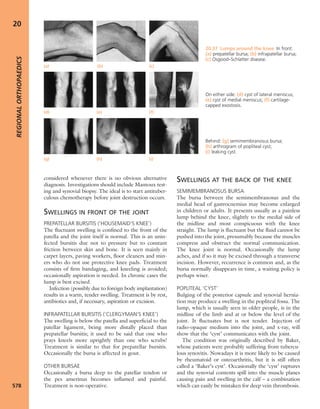 Apley's shoulderjt examination