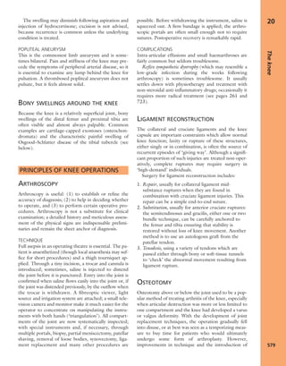 Apley's shoulderjt examination