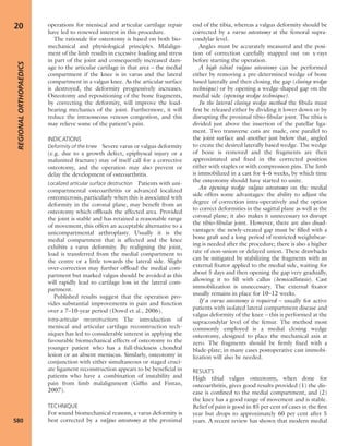 Apley's shoulderjt examination