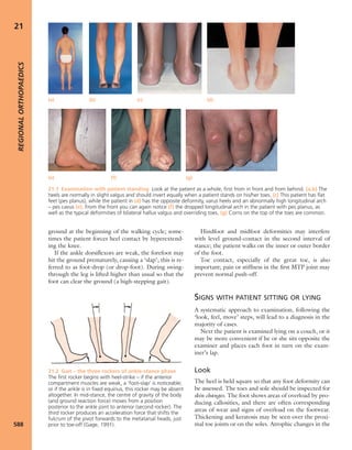 Apley's shoulderjt examination