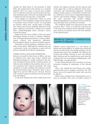 (usually the distal femur or the proximal or distal
tibia), the medial ends of the clavicles or a vertebral
segment. Over the course of several years multiple
sites are affected, sometimes symmetrically and some-
times simultaneously; with each exacerbation the child
is slightly feverish and may have a raised ESR.
X-ray changes are characteristic. There are small
lytic lesions in the metaphysis, usually closely adjacent
to the physis. Some of these ‘cavities’ are surrounded
by sclerosis; others show varying stages of healing.
The clavicle may become markedly thickened. If the
spine is affected, it may lead to collapse of a vertebral
body. Radioscintigraphy shows increased activity
around the lesions.
Biopsy of the lytic focus is likely to show the typical
histological features of acute or subacute inﬂamma-
tion. In longstanding lesions there is a chronic inﬂam-
matory reaction with lymphocyte inﬁltration.
Bacteriological cultures are almost invariably negative.
Treatment is entirely palliative; antibiotics have no
effect on the disease. Although the condition may run
a protracted course, the prognosis is good and the
lesions eventually heal without complications.
STERNO-COSTO-CLAVICULAR HYPEROSTOSIS
Patients are usually in their forties or ﬁfties, and men
are affected more often than women. Clinical and
radiological changes are usually conﬁned to the ster-
num and adjacent bones and the vertebral column. As
with recurrent multifocal osteomyelitis, there is a curi-
ous association with cutaneous pustulosis. The usual
complaint is of pain, swelling and tenderness around
the sternoclavicular joints; sometimes there is also a
slight fever and the ESR may be elevated. Patients
with vertebral column involvement may develop back
pain and stiffness.
X-rays show hyperostosis of the medial ends of the
clavicles, the adjacent sternum and the anterior ends
of the upper ribs, as well as ossiﬁcation of the stern-
oclavicular and costoclavicular ligaments. Vertebral
changes include sclerosis of individual vertebral bod-
ies, ossiﬁcation of the anterior longitudinal ligament,
anterior intervertebral bridging, end-plate erosions,
disc space narrowing and vertebral collapse.
Radioscintigraphy shows increased activity around the
sternoclavicular joints and affected vertebrae.
The condition usually runs a protracted course with
recurrent ‘ﬂares’. There is no effective treatment but
in the long term symptoms tend to diminish or disap-
pear; however, the patient may be left with ankylosis
of the affected joints.
INFANTILE CORTICAL HYPEROSTOSIS
(CAFFEY’S DISEASE)
Infantile cortical hyperostosis is a rare disease of
infants and young children. It usually starts during the
ﬁrst few months of life with painful swelling over the
tubular bones and/or the mandible. The child may be
feverish and irritable, refusing to move the affected
limb. Infection may be suspected but, apart from the
swelling, there are no local signs of inﬂammation. The
ESR, though, is usually elevated.
X-rays characteristically show periosteal new-bone
formation resulting in thickening of the affected
bone.
After a few months the local features may resolve
spontaneously, only to reappear somewhere else. Flat
bones, such as the scapula and cranial vault, may also
be affected.
Other causes of hyperostosis (osteomyelitis, scurvy)
must be excluded. The cause of Caffey’s disease is
GENERALORTHOPAEDICS
42
2
(a) (b) (c) (d)
2.6 Caffey’s
disease This infant
with Caffey’s
disease developed
marked thickening
of the mandible and
long bones. The
lesions gradually
cleared up, leaving
little or no trace of
their former
ominous
appearance.
 
