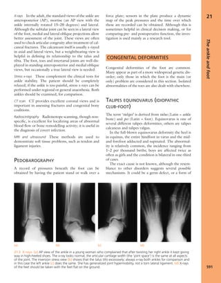 Apley's shoulderjt examination
