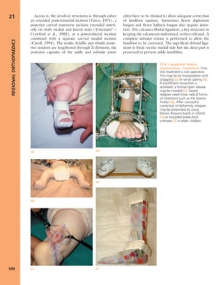 Apley's shoulderjt examination