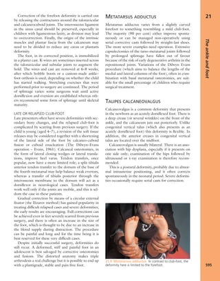 Apley's shoulderjt examination