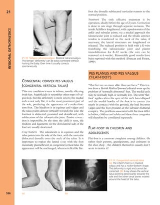 Apley's shoulderjt examination