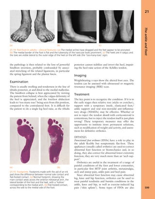 Apley's shoulderjt examination