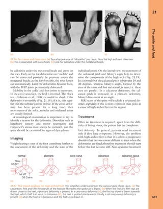 Apley's shoulderjt examination