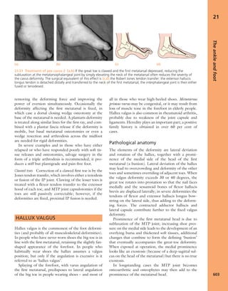 Apley's shoulderjt examination