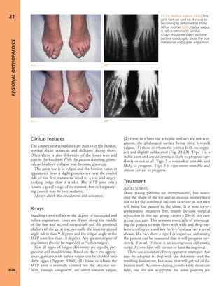 Apley's shoulderjt examination