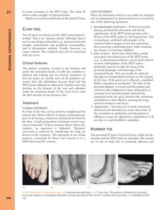 Apley's shoulderjt examination