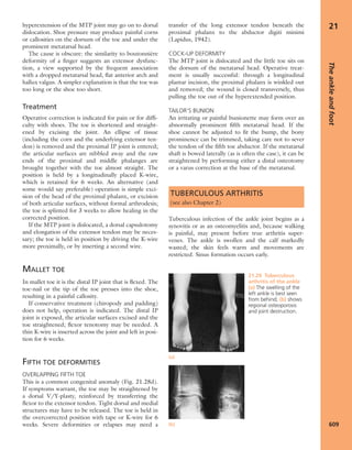 Apley's shoulderjt examination