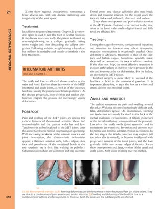 Apley's shoulderjt examination