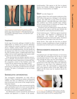 Apley's shoulderjt examination