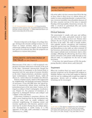 Apley's shoulderjt examination