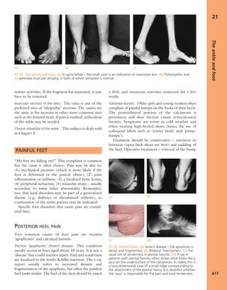 Apley's shoulderjt examination