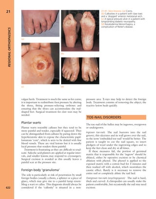 Apley's shoulderjt examination