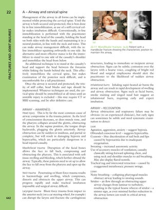 Apley's shoulderjt examination