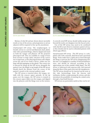 Apley's shoulderjt examination