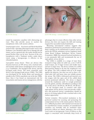Apley's shoulderjt examination