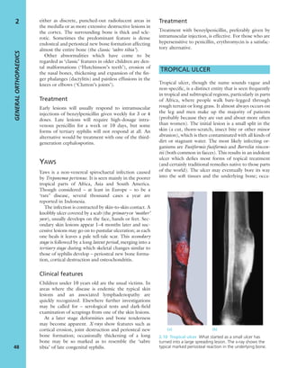 either as discrete, punched-out radiolucent areas in
the medulla or as more extensive destructive lesions in
the cortex. The surrounding bone is thick and scle-
rotic. Sometimes the predominant feature is dense
endosteal and periosteal new bone formation affecting
almost the entire bone (the classic ‘sabre tibia’).
Other abnormalities which have come to be
regarded as ‘classic’ features in older children are den-
tal malformations (‘Hutchinson’s teeth’), erosion of
the nasal bones, thickening and expansion of the ﬁn-
ger phalanges (dactylitis) and painless effusions in the
knees or elbows (‘Clutton’s joints’).
Treatment
Early lesions will usually respond to intramuscular
injections of benzylpenicillin given weekly for 3 or 4
doses. Late lesions will require high-dosage intra-
venous penicillin for a week or 10 days, but some
forms of tertiary syphilis will not respond at all. An
alternative would be treatment with one of the third-
generation cephalosporins.
YAWS
Yaws is a non-venereal spirochaetal infection caused
by Treponema pertenue. It is seen mainly in the poorer
tropical parts of Africa, Asia and South America.
Though considered – at least in Europe – to be a
‘rare’ disease, several thousand cases a year are
reported in Indonesia.
The infection is contracted by skin-to-skin contact. A
knobbly ulcer covered by a scab (the primary or ‘mother’
yaw), usually develops on the face, hands or feet. Sec-
ondary skin lesions appear 1–4 months later and suc-
cessive lesions may go on to pustular ulceration; as each
one heals it leaves a pale tell-tale scar. This secondary
stage is followed by a long latent period, merging into a
tertiary stage during which skeletal changes similar to
those of syphilis develop – periosteal new bone forma-
tion, cortical destruction and osteochondritis.
Clinical features
Children under 10 years old are the usual victims. In
areas where the disease is endemic the typical skin
lesions and an associated lymphadenopathy are
quickly recognized. Elsewhere further investigations
may be called for – serological tests and dark-ﬁeld
examination of scrapings from one of the skin lesions.
At a later stage deformities and bone tenderness
may become apparent. X-rays show features such as
cortical erosion, joint destruction and periosteal new
bone formation; occasionally thickening of a long
bone may be so marked as to resemble the ‘sabre
tibia’ of late congenital syphilis.
Treatment
Treatment with benzylpenicillin, preferably given by
intramuscular injection, is effective. For those who are
hypersensitive to penicillin, erythromycin is a satisfac-
tory alternative.
TROPICAL ULCER
Tropical ulcer, though the name sounds vague and
non-speciﬁc, is a distinct entity that is seen frequently
in tropical and subtropical regions, particularly in parts
of Africa, where people walk bare-legged through
rough terrain or long grass. It almost always occurs on
the leg and men make up the majority of patients
(probably because they are out and about more often
than women). The initial lesion is a small split in the
skin (a cut, thorn-scratch, insect bite or other minor
abrasion), which is then contaminated with all kinds of
dirt or stagnant water. The most likely infecting or-
ganisms are Fusiformis fusiformis and Borrelia vincen-
tii (both common in faeces). This results in an indolent
ulcer which deﬁes most forms of topical treatment
(and certainly traditional remedies native to those parts
of the world). The ulcer may eventually bore its way
into the soft tissues and the underlying bone; occa-
GENERALORTHOPAEDICS
48
2
(a) (b)
2.10 Tropical ulcer What started as a small ulcer has
turned into a large spreading lesion. The x-ray shows the
typical marked periosteal reaction in the underlying bone.
 