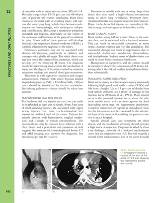 Apley's shoulderjt examination