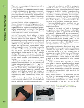 Apley's shoulderjt examination