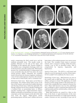 Apley's shoulderjt examination