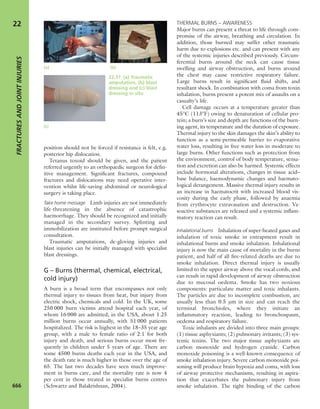 Apley's shoulderjt examination