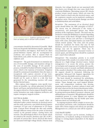 Apley's shoulderjt examination