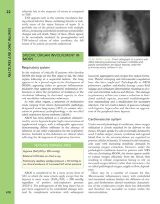 Apley's shoulderjt examination