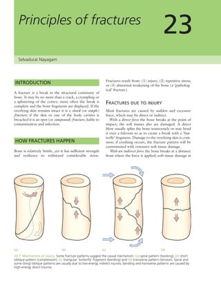 Apley's shoulderjt examination