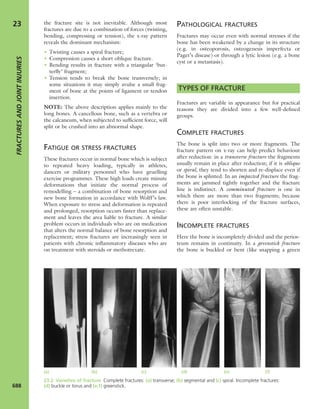 Apley's shoulderjt examination