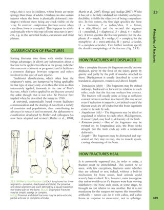 Apley's shoulderjt examination