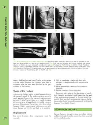 Apley's shoulderjt examination