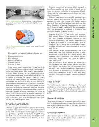 Apley's shoulderjt examination