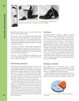 Apley's shoulderjt examination