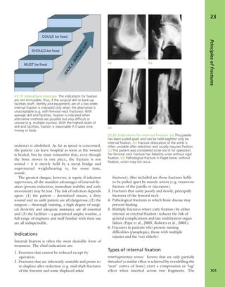 Apley's shoulderjt examination
