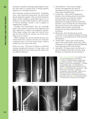 Apley's shoulderjt examination
