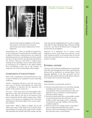 Apley's shoulderjt examination