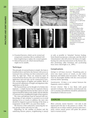 Apley's shoulderjt examination