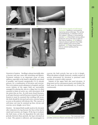 Apley's shoulderjt examination