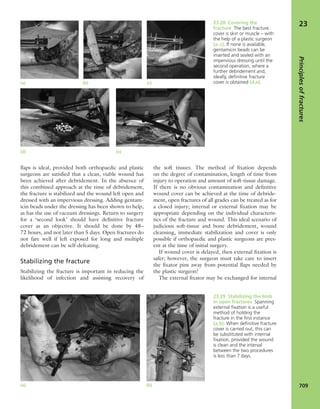 Apley's shoulderjt examination