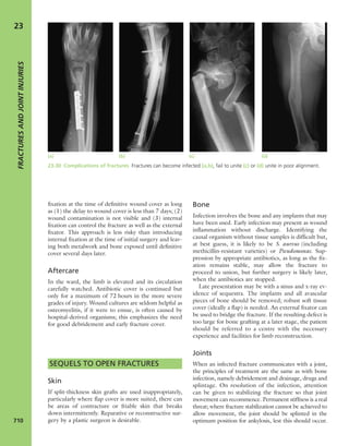 Apley's shoulderjt examination