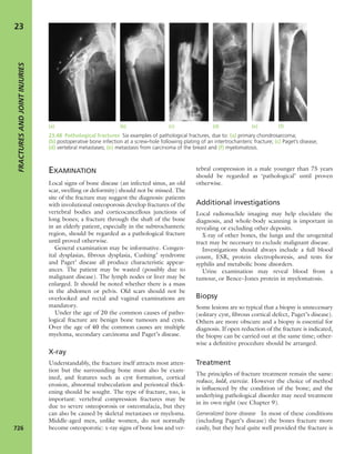 Apley's shoulderjt examination