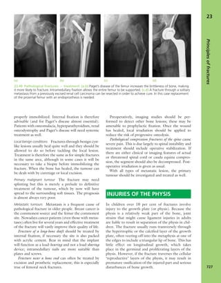 Apley's shoulderjt examination