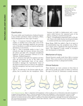 Apley's shoulderjt examination