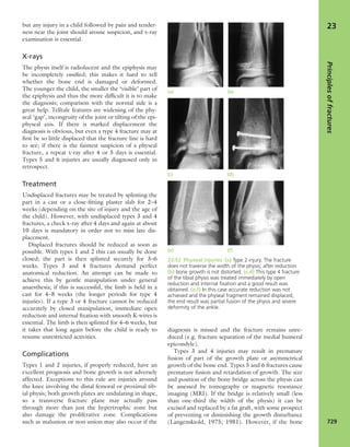 Apley's shoulderjt examination
