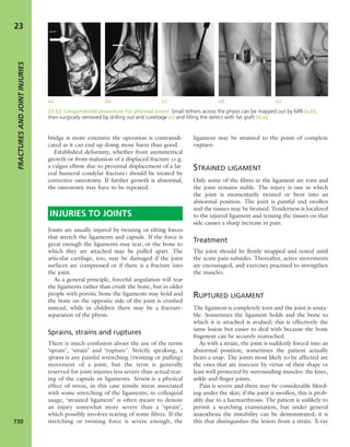 Apley's shoulderjt examination